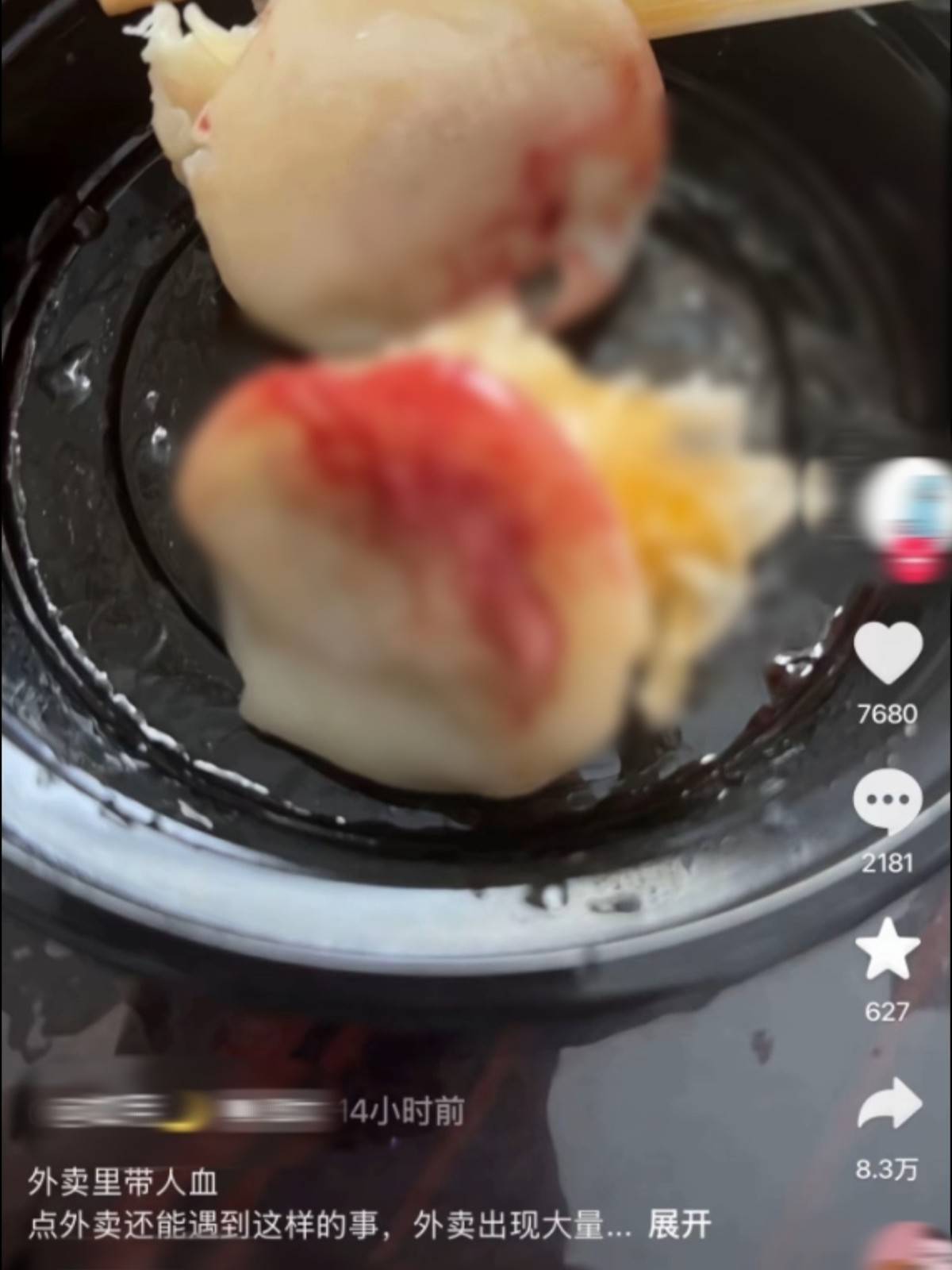 杭州一网友称外卖餐食中有血,自行就医并服用阻断药,市监人员:系店员手部受伤流的血,双方已和解